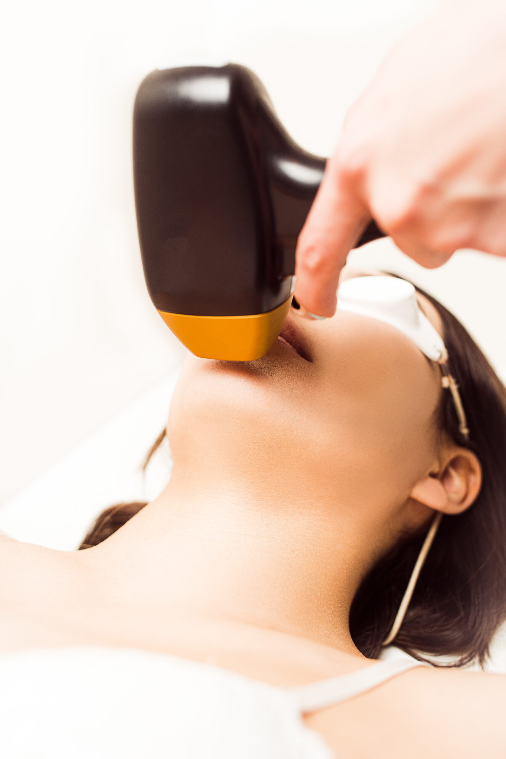 Kin laserontharen permanent bij NovaSkin Pro in amsterdam