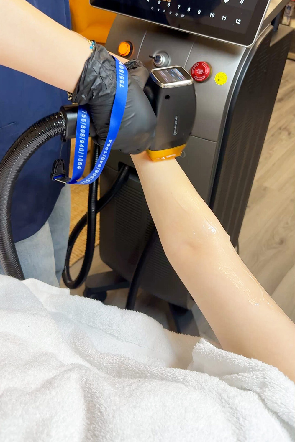 vrouwen in amsterdam bij NovaSkin pro